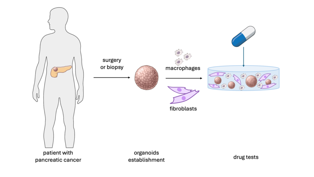 Infographic illustrating research process from patient with pancreatic cancer, to surgery or biopsy, to establishing organoids, to drug tests